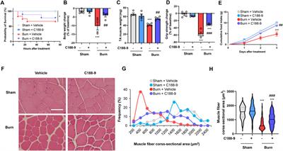 C188-9, a specific inhibitor of STAT3 signaling, prevents thermal burn-induced skeletal muscle wasting in mice